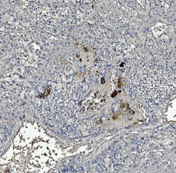 CRP Antibody / C-Reactive Protein