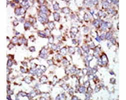 TAK1 Antibody