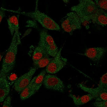 Amyloid beta Antibody / APP