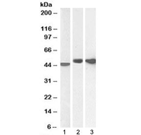 Western blot testing of 1) human cerebellum, 2) mouse brain and 3) rat brain lysate with GFAP antibo