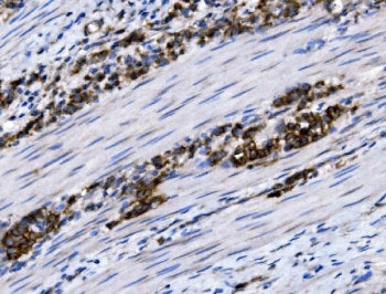 NKCC1 Antibody / SLC12A2