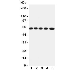 OCTN2 Antibody SLC22A5