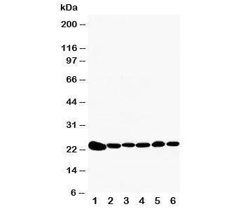 Western blot testing of Peroxiredoxin 2 antibody and Lane 1: rat brain; 2: rat kidney; 3: HeLa; 4: J
