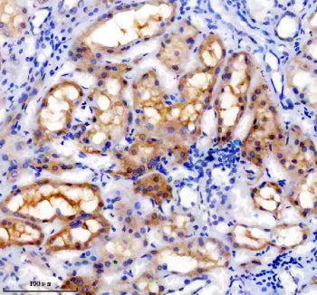 IHC staining of FFPE human kidney tissue with TRAIL-R4 antibody, HRP-secondary and DAB substrate. HI