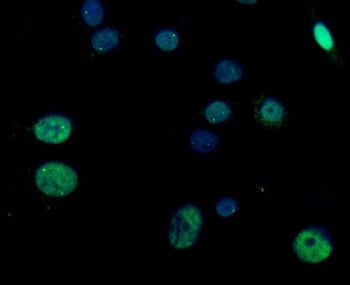 RGS12 Antibody / Regulator of G-protein signaling 12