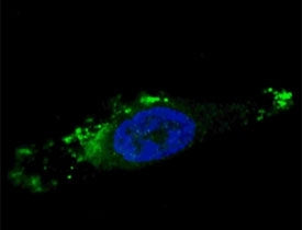 Fluorescent image of chloroquine-treated U251 cells stained with ATG12 antibody. Alexa Fluor 488 con