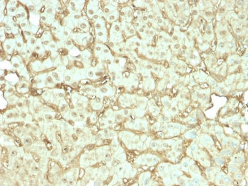 IHC staining of FFPE human liver tissue with recombinant Albumin antibody (clone rALB/6412). HIER: b