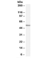 Western blot testing of human tonsil lysate with WIPF1 antibody at 0.03ug/ml. Commonly observed mole
