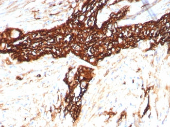 IHC staining of FFPE human colon tissue with recombinant NCAM antibody (clone rNCAM1/8758). HIER: bo
