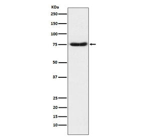 Western blot testing of human fetal brain lysate with NTN1 antibody. Expected molecular weight: 68-7