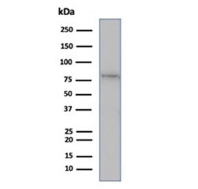 Western blot testing of human Jurkat cell lysate using MLH1 antibody (clone rMLH1/6285). Predicted m