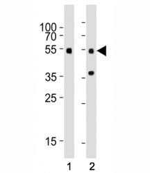 Western blot testing of Smad3 antibody at 1:1000 dilution. Lane 1: mouse brain tissue lysate; 2: rat