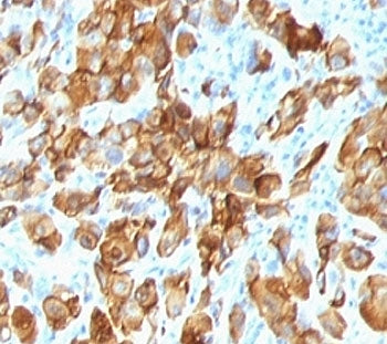 MART-1 / Melan-A Antibody