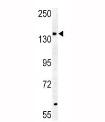 ABCB4-S639 western blot analysis in mouse heart tissue lysate