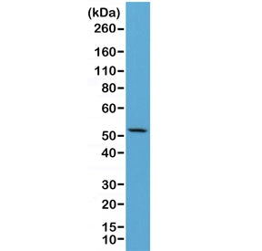 Western blot of human HeLa lysate using recombinant CK7 antibody at 1:2500. Predicted molecular weig