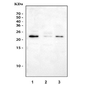 Western blot testing of 1) human A549, 2) rat testis and 3) mouse testis tissue lysate with Gremlin 