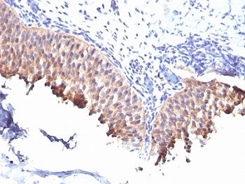 KRT10 Antibody / Cytokeratin 10