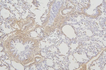 IHC staining of FFPE rat lung with Fam70b antibody. HIER: boil tissue sections in pH8 EDTA for 20 mi