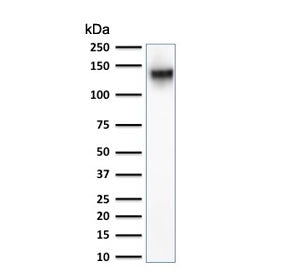 Western blot testing of human K562 cell lysate with CD43 antibody. Expected molecular weight: 45-135