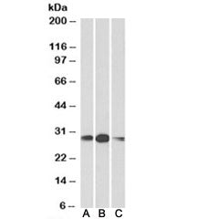 Western blot testing of human [A], mouse [B] and rat [C] kidney lysates with HOXA5 antibody at 1ug/m