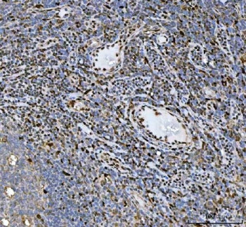 Heat shock factor protein 1 Antibody / HSF1
