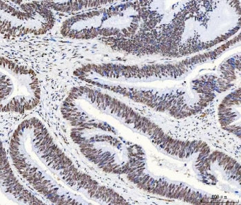 HnRNP H Antibody