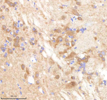 IHC staining of FFPE zebrafish brain tissue with Pafah1b1 antibody, HRP-labeled secondary and DAB su