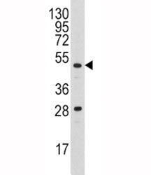 Urokinase Antibody (UPA, Plau)