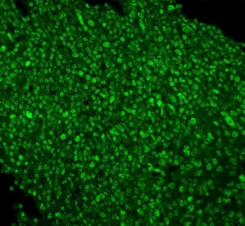 Immunofluorescent staining of FFPE human tonsil with PTBP1 antibody. HIER: steam section in pH6 citr