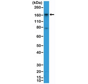 Western blot testing of human HepG2 cell lysate with recombinant CD13 antibody at 1:2000 dilution. E