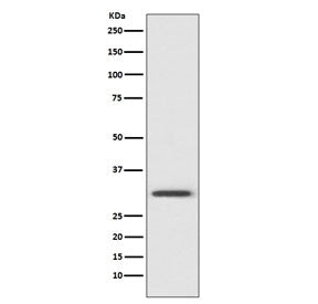 Western blot testing of human HeLa cell lysate with Annexin V antibody. Predicted molecular weight ~