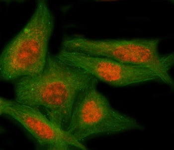 Immunofluorescent staining of FFPE human HeLa cells with NAP1L5 antibody (red) and Beta Tubulin mAb 
