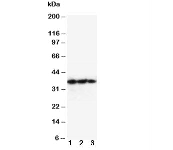 Western blot testing of EPO antibody and Lane 1: Recombinant human protein 10ng; 2: 5ng; 3: 2.5ng. P