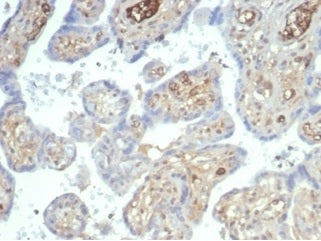 Recombinant AFP Antibody / Alpha Fetoprotein