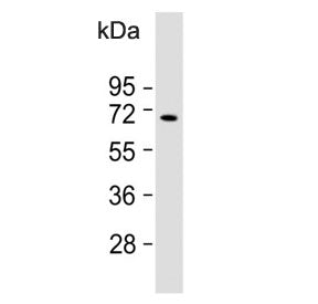 Western blot testing of human Ramos cell lysate with KNG1 antibody. Predicted molecular weight ~72 k