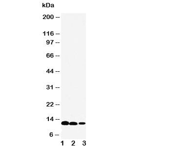 Western blot testing of IL-13 antibody and Lane 1: recombinant human protein 10ng; 2: 5ng; 3: 2.5ng