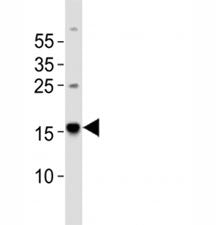 Zebrafish Map1lc3a Antibody