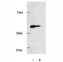 Western blot testing of HDAC1 antibody and HEK293 cells. Knockdown using siRNA showed a significant 