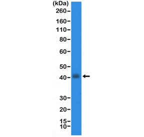 Western blot testing of human TT cell lysate with recombinant Thyroid transcription factor 1 antibod