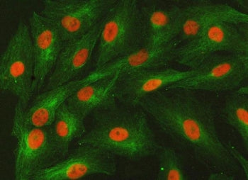 SNF2L2 Antibody / Probable global transcription activator SNF2L2 / SMARCA2
