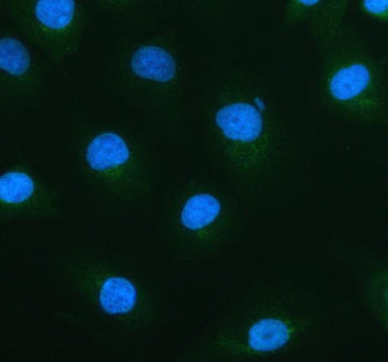 ACOX1 Antibody / Peroxisomal acyl-coenzyme A oxidase 1, 100ug