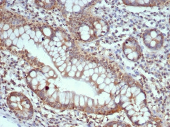 IHC staining of FFPE human small intestine tissue with Calbindin D9K antibody (clone S100G/7516). HI