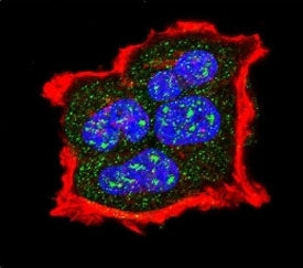 Confocal immunofluorescent analysis of phospho-TSC2 antibody with MCF-7 cells followed by Alexa Fluo