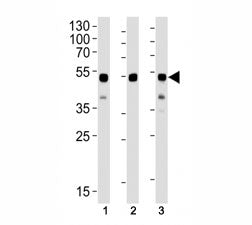 GATA3 Antibody