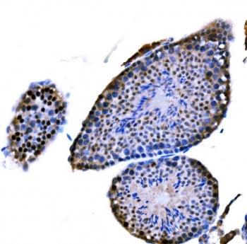 DMC1 Antibody