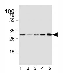 CDK5 Antibody