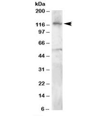 Western blot testing of Jurkat lysate with HLTF antibody at 0.5ug/ml. Predicted molecular weight: ~1