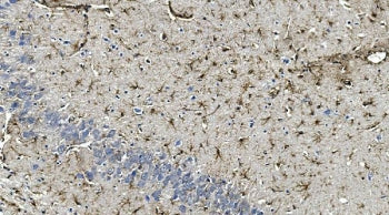 IHC staining of FFPE rat brain with GFAP antibody. HIER: boil tissue sections in pH8 EDTA for 20 min