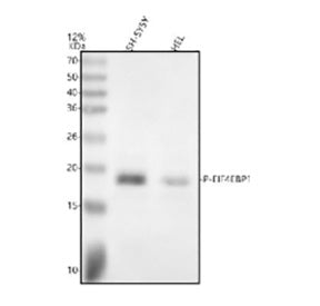Western blot analysis of Phospho-eIF4EBP1 using anti-Phospho-eIF4EBP1 (Thr70) antibody. Electrophore