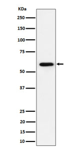 Western blot analysis of PRPF31 expression in human Jurkat cell lysate using the PRPF31 antibody. Pr